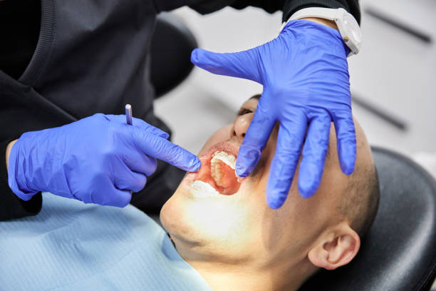 Best Emergency Treatment for Oral Infections in West Glendive, MT